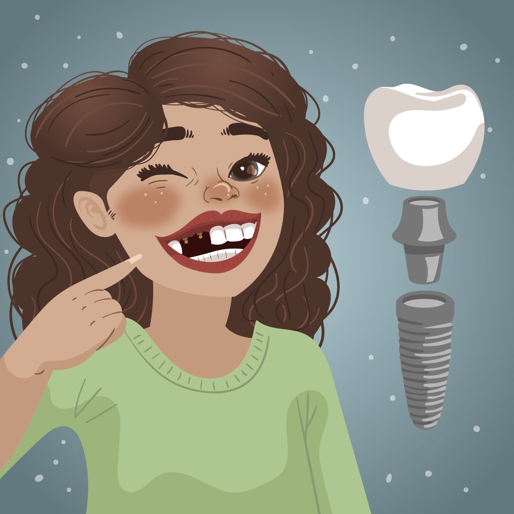 Dental implants in Houston