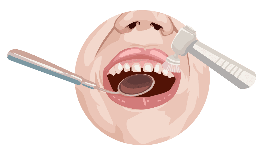 Dental Cleaning Saves Money